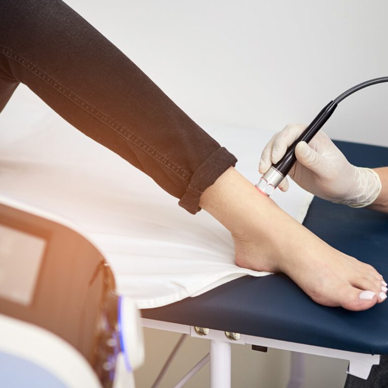 varicose vein (1) (1)